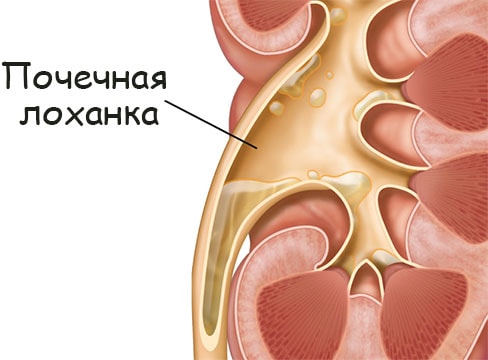 Кракен гидра